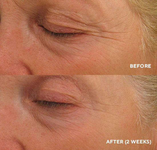 Eye Authority (Círculos oscuros, bolsas, líneas finas) Tamaño de Viaje 0.17 FL oz | 5ml