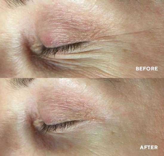 PolyPeptide Collagel (Mascarilla HydroGel para Ojos)