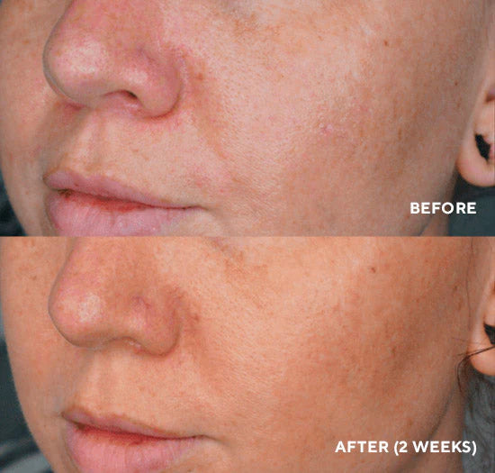 LUMAPRO C Serum (Corrector de pigmentos para aclarar la piel) Tamaño de Viaje 0.17 FL oz | 5 ml