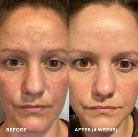 Firma-Bright (20% de Refuerzo de Vitamina C)