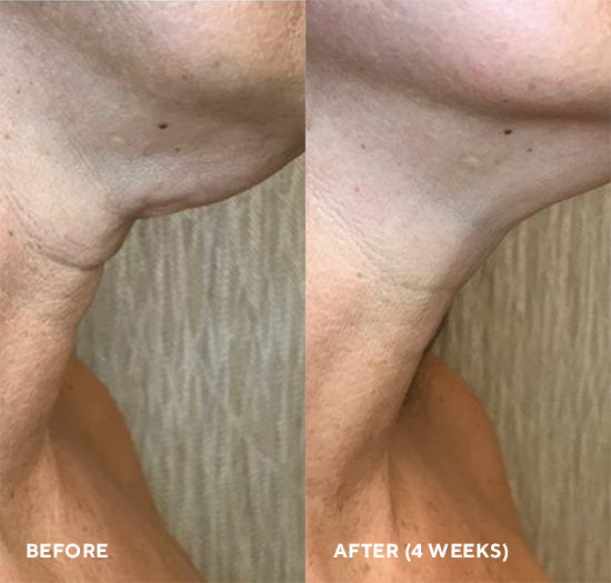 FIRM-A-FIX NECTAR (Suero Lifting Cuello y Escote)